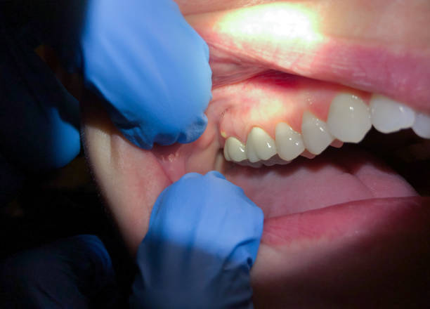 Emergency Dentist for Kids in TN