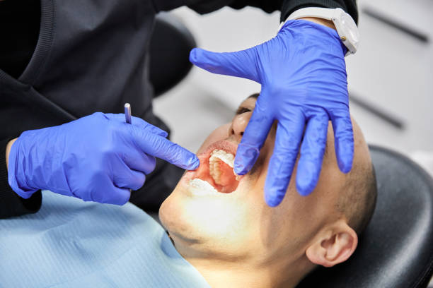 Best Dentist for Tooth Abscess  in Chapel Hill, TN