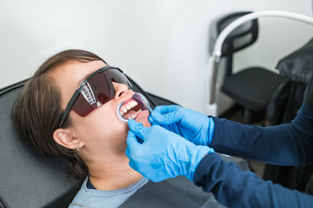 Best Teeth Whitening  in Chapel Hill, TN