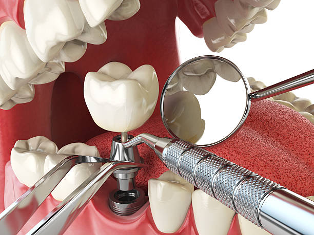 Best Emergency Tooth Extraction  in Chapel Hill, TN
